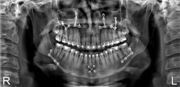 Curso Superior de Tecnologia em Radiologia FATESA