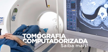 Tomografia Computadorizada Geral, saiba mais!