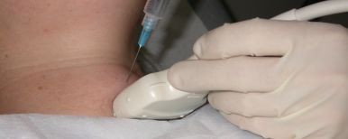 O papel da ultrassonografia na biópsia de tireoide