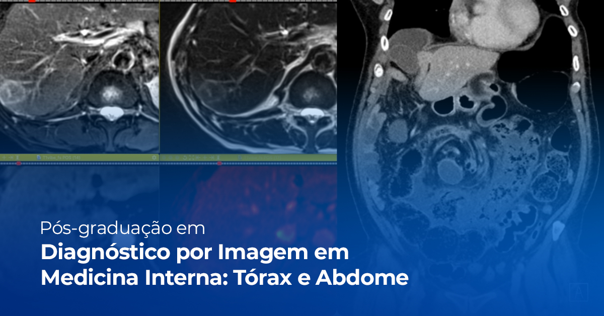 Imagem do blog sobre especialização
